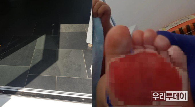 아이가 화상을 입은 뜨거운 주방 바닥과 아이의 발바닥/(사진=나타샤 페이스북 캡처)
